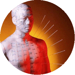 acupuncture